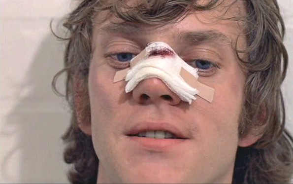 Otomatik Portakal Fotoğrafı