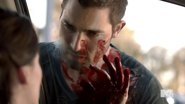 Teen Wolf Fotoğrafı