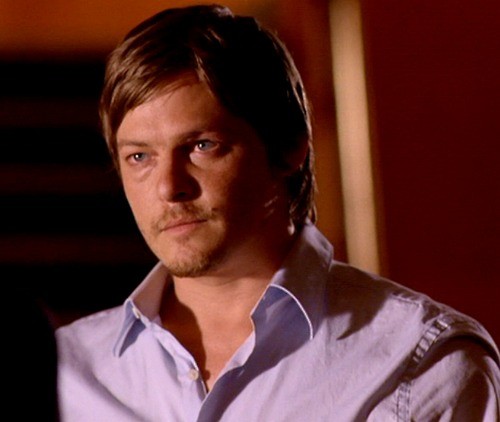 Sigara Yanıkları fotoğrafı