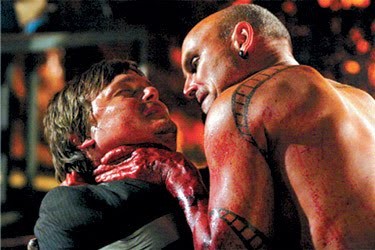 Sigara Yanıkları fotoğrafı