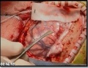 Muhteşem Makina İnsan Vücudu fotoğrafı