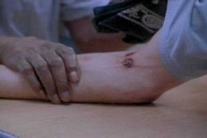 The Fence fotoğrafı