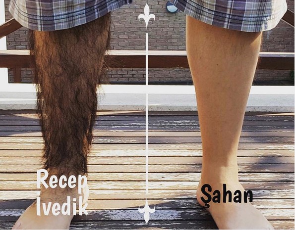 Recep İvedik 5 Fotoğrafı