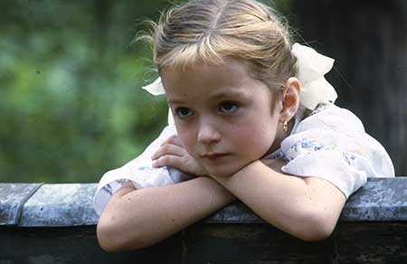 Güneş Yanığı Fotoğrafı