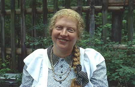 Güneş Yanığı Fotoğrafı