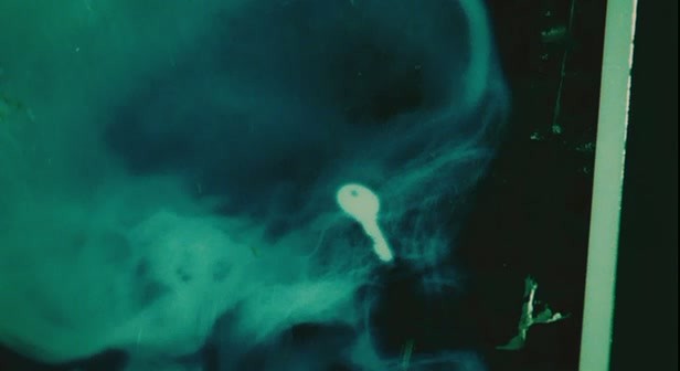 Testere 2 Fotoğrafı