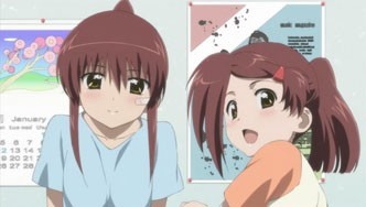 Kiss X Sis Fotoğrafı