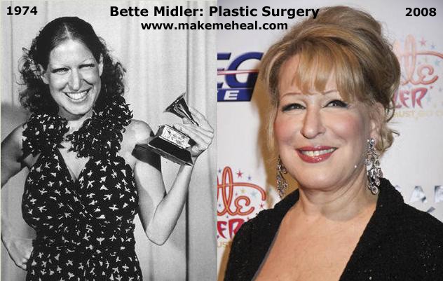 Bette Midler Fotoğrafı