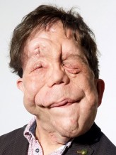 Adam Pearson fotoğrafı