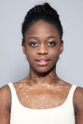 Michaela Deprince fotoğrafı